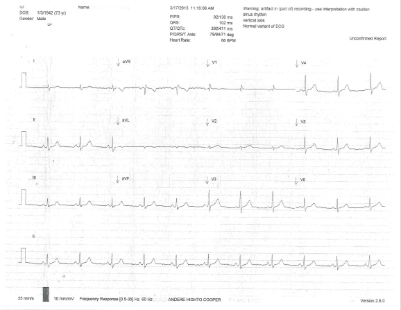 ekg March 17, 2015