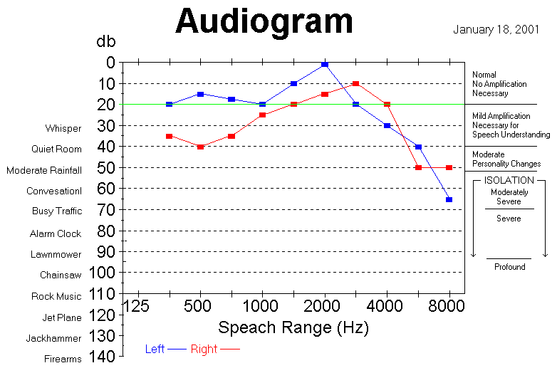 Audiogram