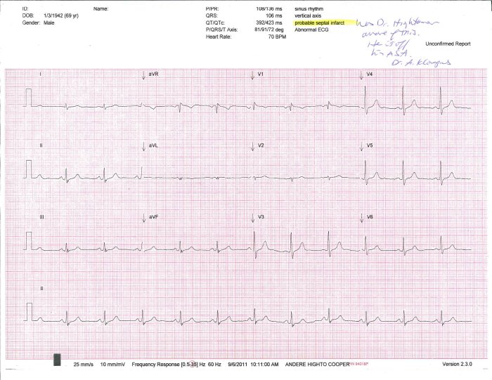 ekg september 5, 2011